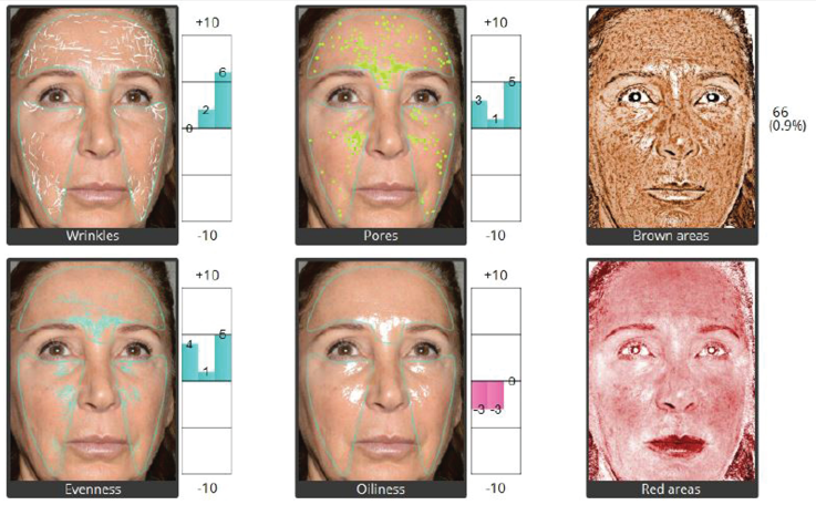 Facial analysis for Emface EYE, Deusaderm, and Hyalual Electri procedures